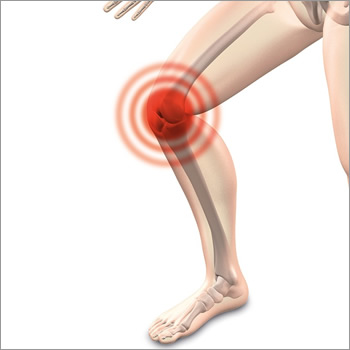 Uvoider Compression Knee Sleeves – Tips for Preventing Runner’s Knee